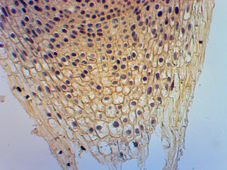 02001pth-f366-321x241.png