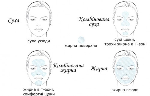 02006d6l-4ed7.png