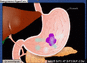 02007x1t-b440-87x63.gif