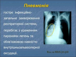 02009xe2-d986-320x240.jpg