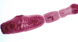 02009xx0-85bb-252x137.png