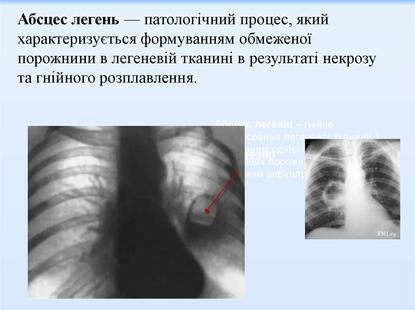 0200akn2-7758-415x310.jpg