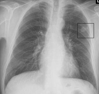 0200cay4-c967-340x322.jpg