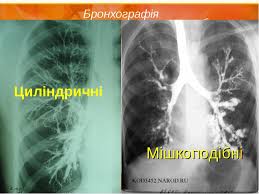 0200g9d3-6f26.jpg