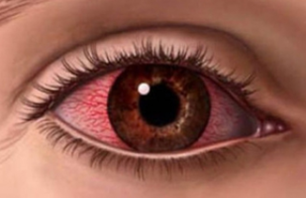 0200gzr7-c1d7-306x198.png