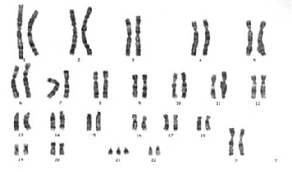 0200mg7b-d3c8-417x246.png
