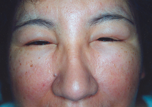 0200otko-6767-301x211.png