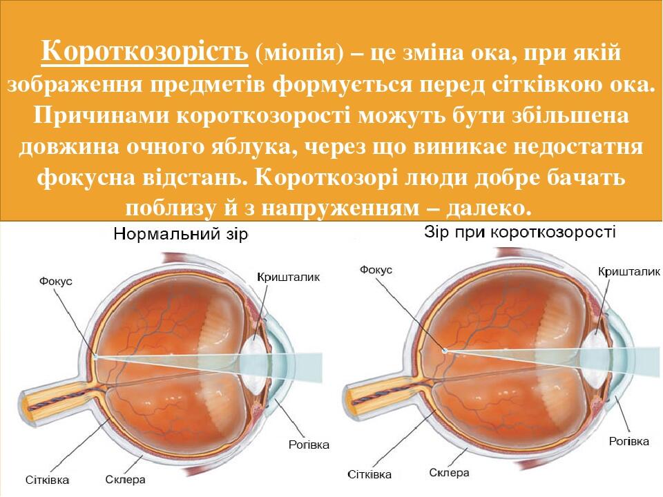 Колодки перед ока