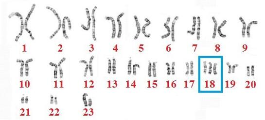 0200t3rq-b474-545x248.jpg