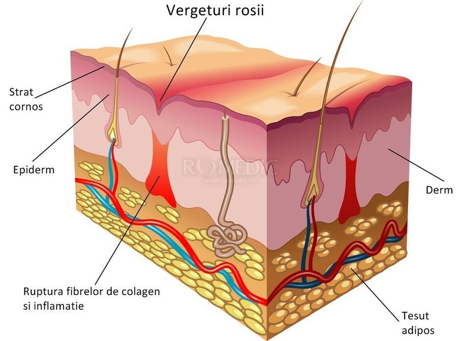Pielea | Anatomie si fiziologie