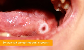0200wbaz-30a6-356x212.jpg