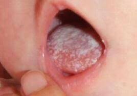 0200wbd4-3db6-322x226.jpg