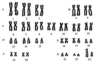 0200zf3v-986e-338x221.png
