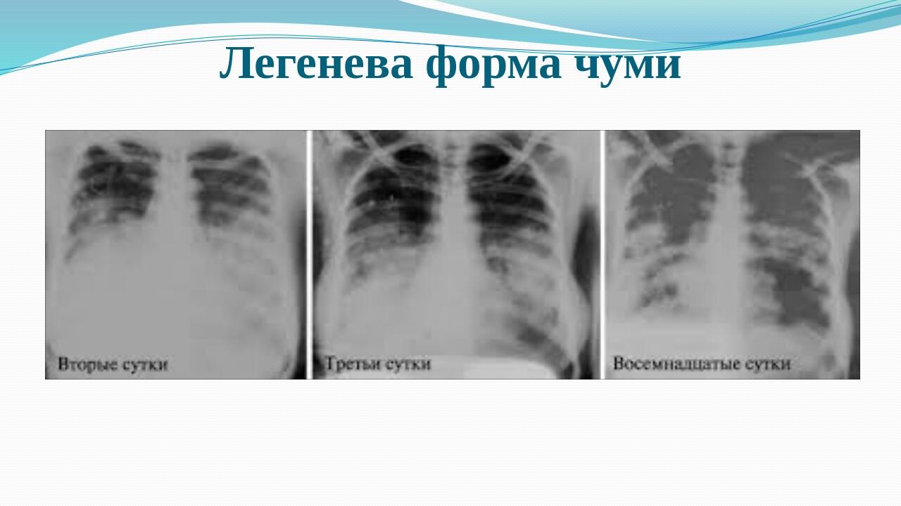 Лекція для студентів 3 курсу відділення "Лікувальна справа" на тему ...