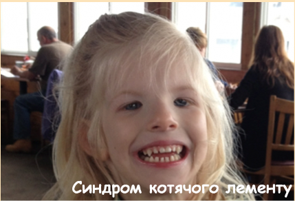 02012cdq-304d-429x292.png