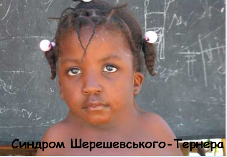 02012cdr-483a-443x308.png