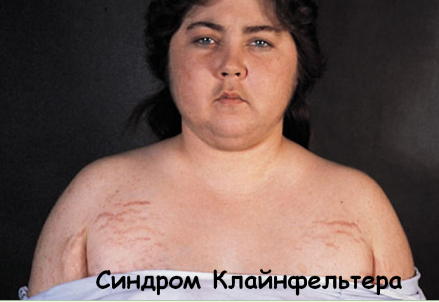 02012cds-ebe1-439x302.png