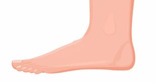 Outside Foot Pain - Symptoms, Causes, Treatment & Rehabilitation