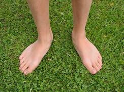 Ask the physio: Splayed feet