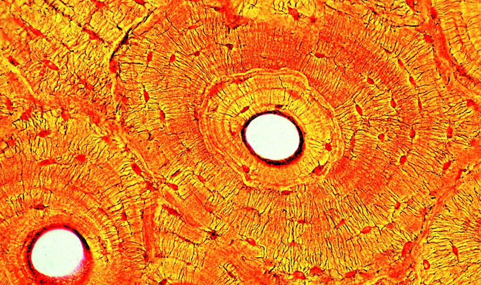 02012nde-9b23-940x557.png