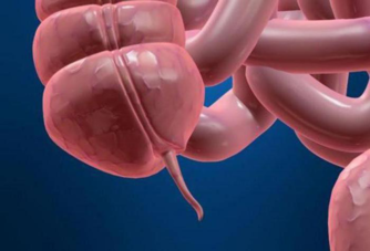 02013mgy-daa0-700x476.png