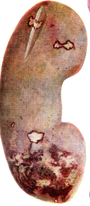 02013wxl-6057-90x206.png