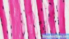 РІЗНИЦЯ МІЖ СПОЛУЧНОЮ ТКАНИНОЮ ТА М'ЯЗОВОЮ ТКАНИНОЮ | ПОРІВНЯЙТЕ РІЗНИЦЮ МІЖ ПОДІБНИМИ ТЕРМІНАМИ - НАУКА - 2021