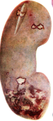 02016epb-a60e-104x237.png