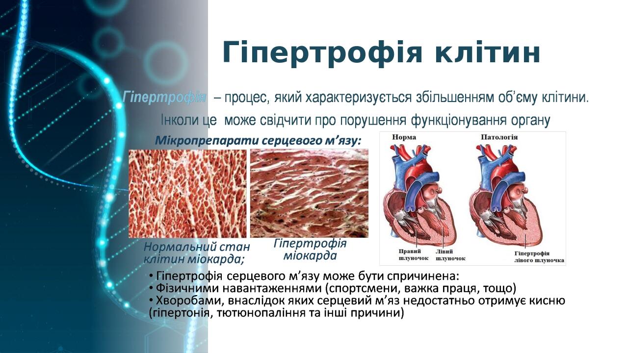 Гіпертрофія клітин