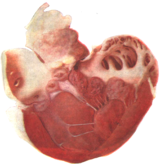 0201adp6-05c8-161x164.png