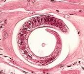 52 Gambar Cacing Trichinella Spiralis Paling Bagus - Gambar Pixabay