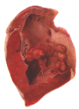0201dlv7-1cb3-156x217.png