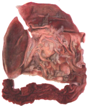 0201dlvs-acc9-186x219.png
