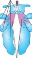 0201lwzf-cf5c-66x117.jpg